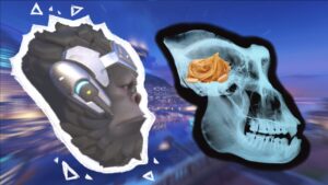 Overwatch 2 But My Teammates Are Lobotomized